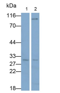 Invitrogen NOTCH2NL Polyclonal Antibody:Antibodies:Primary Antibodies