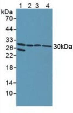 Invitrogen NOTCH2NL Polyclonal Antibody:Antibodies:Primary Antibodies