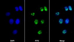 Invitrogen NPM1 Polyclonal Antibody 200 &mu;L; Unconjugated:Antibodies,
