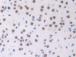 Invitrogen NPM1 Polyclonal Antibody 20 &mu;L; Unconjugated:Antibodies,