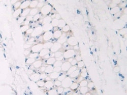Invitrogen NPM1 Polyclonal Antibody 200 &mu;L; Unconjugated:Antibodies,