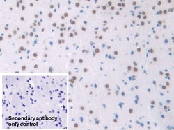 Invitrogen NPM1 Polyclonal Antibody 200 &mu;L; Unconjugated:Antibodies,