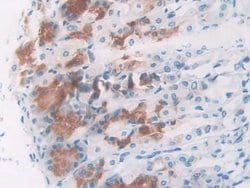 Invitrogen NPM1 Polyclonal Antibody 20 &mu;L; Unconjugated:Antibodies,