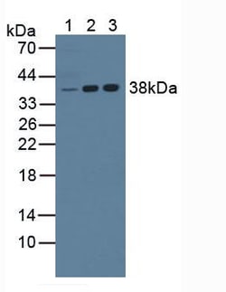 Invitrogen NPM1 Polyclonal Antibody 200 &mu;L; Unconjugated:Antibodies,