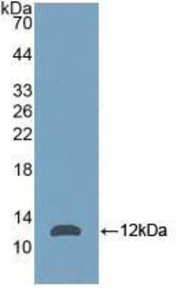 Invitrogen NPM1 Polyclonal Antibody 20 &mu;L; Unconjugated:Antibodies,