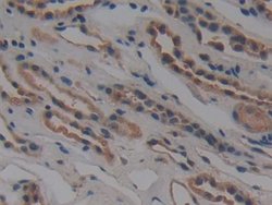 Invitrogen NUP155 Polyclonal Antibody 20 &mu;L; Unconjugated:Antibodies,