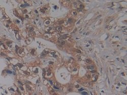Invitrogen NUP155 Polyclonal Antibody 20 &mu;L; Unconjugated:Antibodies,