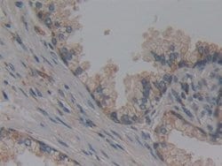 Invitrogen NUP155 Polyclonal Antibody 20 &mu;L; Unconjugated:Antibodies,