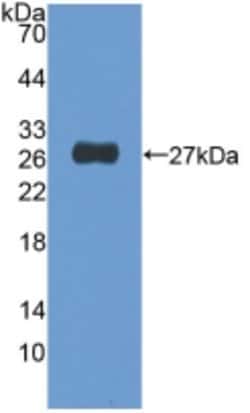 Invitrogen NUP155 Polyclonal Antibody 20 &mu;L; Unconjugated:Antibodies,