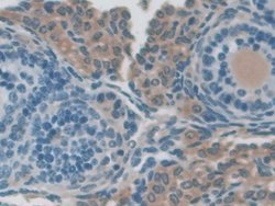 Invitrogen NXN Polyclonal Antibody 20 &mu;L; Unconjugated:Antibodies, Polyclonal