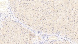 Invitrogen NUMB Polyclonal Antibody:Antibodies:Primary Antibodies