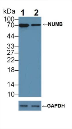 Invitrogen NUMB Polyclonal Antibody:Antibodies:Primary Antibodies