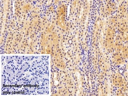 Invitrogen MGMT Polyclonal Antibody:Antibodies:Primary Antibodies