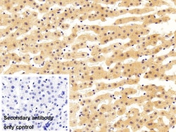 Invitrogen MGMT Polyclonal Antibody:Antibodies:Primary Antibodies