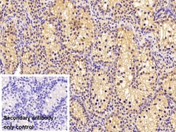 Invitrogen MGMT Polyclonal Antibody:Antibodies:Primary Antibodies