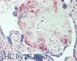 Invitrogen ORM2 Polyclonal Antibody 200 &mu;L; Unconjugated:Antibodies,