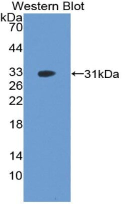 Invitrogen PAK2 Polyclonal Antibody 20 &mu;L; Unconjugated:Antibodies,