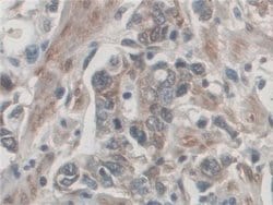 Invitrogen Palladin Polyclonal Antibody:Antibodies:Primary Antibodies