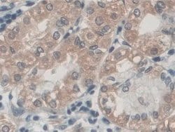 Invitrogen Palladin Polyclonal Antibody:Antibodies:Primary Antibodies