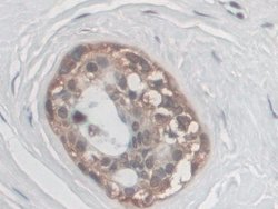 Invitrogen Palladin Polyclonal Antibody:Antibodies:Primary Antibodies
