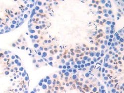 Invitrogen CELA1 Polyclonal Antibody 20 &mu;L; Unconjugated:Antibodies,
