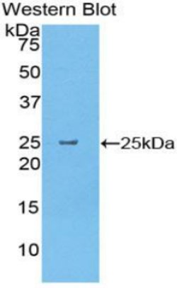 Invitrogen CELA1 Polyclonal Antibody 20 &mu;L; Unconjugated:Antibodies,