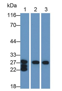 Invitrogen CELA1 Polyclonal Antibody 20 &mu;L; Unconjugated:Antibodies,