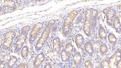 Invitrogen PON2 Polyclonal Antibody:Antibodies:Primary Antibodies