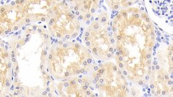 DJ-1 Polyclonal Antibody, Invitrogen 20 &mu;L; Unconjugated:Antibodies,