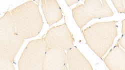 DJ-1 Polyclonal Antibody, Invitrogen 20 &mu;L; Unconjugated:Antibodies,