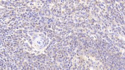 DJ-1 Polyclonal Antibody, Invitrogen 20 &mu;L; Unconjugated:Antibodies,