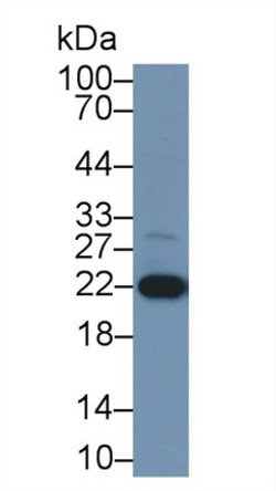 DJ-1 Polyclonal Antibody, Invitrogen 20 &mu;L; Unconjugated:Antibodies,