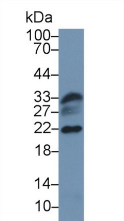 DJ-1 Polyclonal Antibody, Invitrogen 20 &mu;L; Unconjugated:Antibodies,
