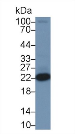 DJ-1 Polyclonal Antibody, Invitrogen 20 &mu;L; Unconjugated:Antibodies,
