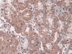 Invitrogen Pepsin Polyclonal Antibody 200 &mu;L; Unconjugated:Antibodies,