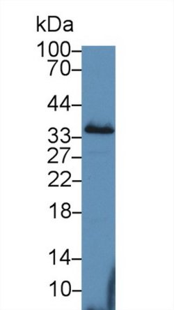 Invitrogen PEX2 Polyclonal Antibody:Antibodies:Primary Antibodies