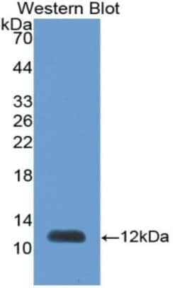 Invitrogen PEX2 Polyclonal Antibody:Antibodies:Primary Antibodies