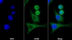 Invitrogen PFKP Polyclonal Antibody 200 &mu;L; Unconjugated:Antibodies,