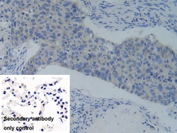 Invitrogen PFKP Polyclonal Antibody 200 &mu;L; Unconjugated:Antibodies,