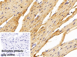Invitrogen PFKP Polyclonal Antibody 200 &mu;L; Unconjugated:Antibodies,