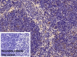 Invitrogen PFKP Polyclonal Antibody 200 &mu;L; Unconjugated:Antibodies,