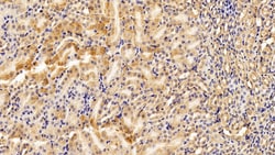Invitrogen PFKP Polyclonal Antibody 200 &mu;L; Unconjugated:Antibodies,