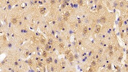 Invitrogen PFKP Polyclonal Antibody 200 &mu;L; Unconjugated:Antibodies,