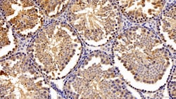 Invitrogen PFKP Polyclonal Antibody 200 &mu;L; Unconjugated:Antibodies,
