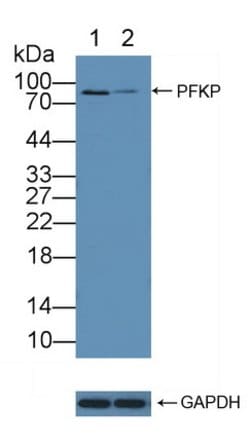 Invitrogen PFKP Polyclonal Antibody 200 &mu;L; Unconjugated:Antibodies,