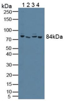 Invitrogen PFKP Polyclonal Antibody 200 &mu;L; Unconjugated:Antibodies,