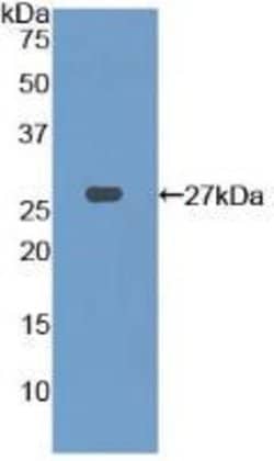 Invitrogen PFKP Polyclonal Antibody 200 &mu;L; Unconjugated:Antibodies,