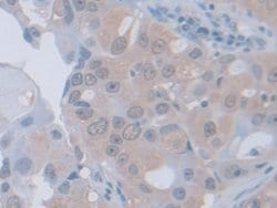 Invitrogen PGM1 Polyclonal Antibody 200 &mu;L; Unconjugated:Antibodies,