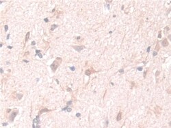 Invitrogen PGM1 Polyclonal Antibody 200 &mu;L; Unconjugated:Antibodies,