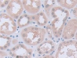 Invitrogen PGM1 Polyclonal Antibody 200 &mu;L; Unconjugated:Antibodies,